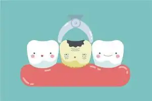 梦见修牙是什么意思
